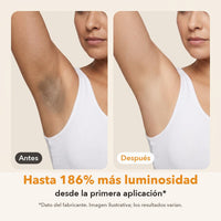 Antes y después: axila con tono más uniforme y luminoso