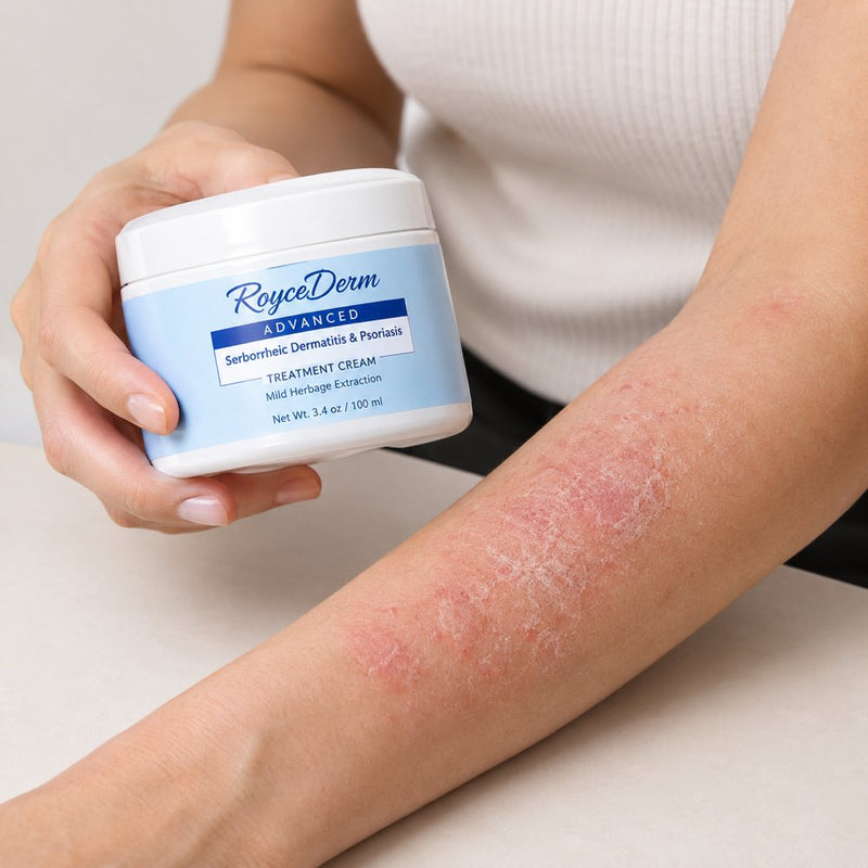 RoyceDerm Advanced — Crema para Dermatitis, Psoriasis y Eccema
