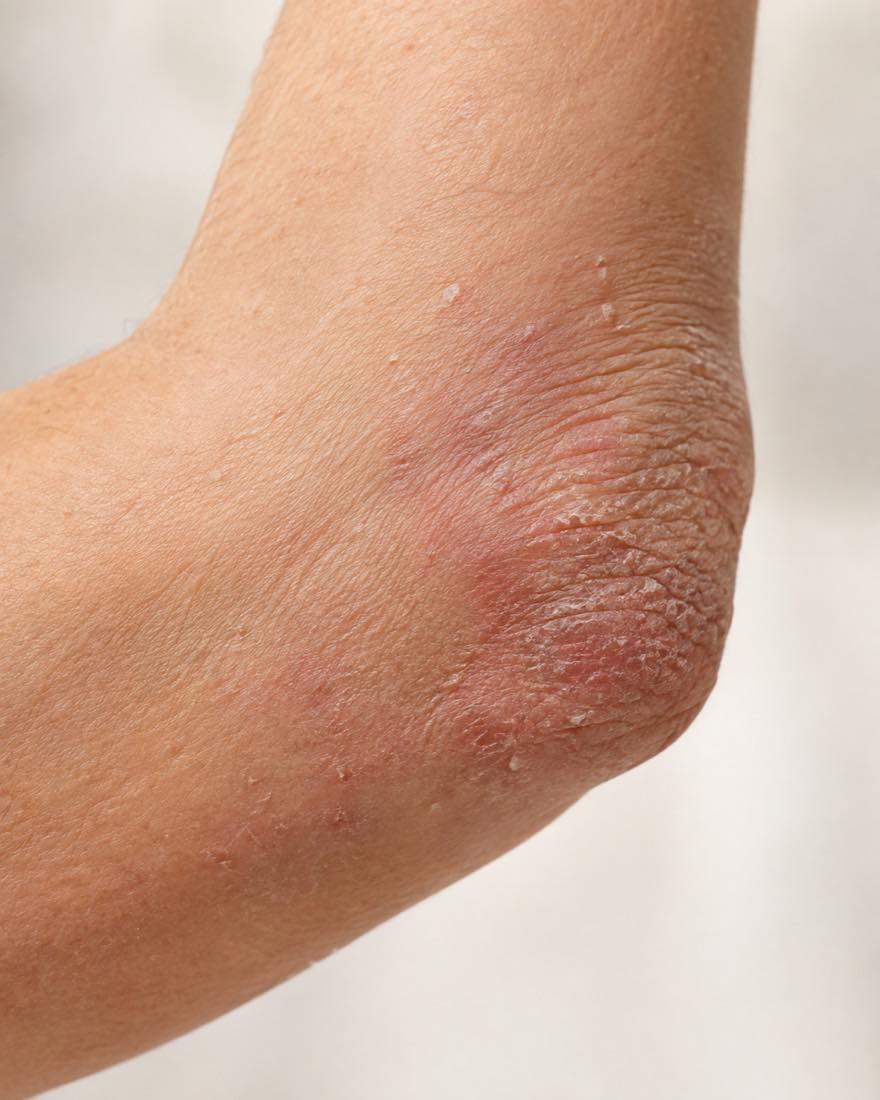 Piel con irritación